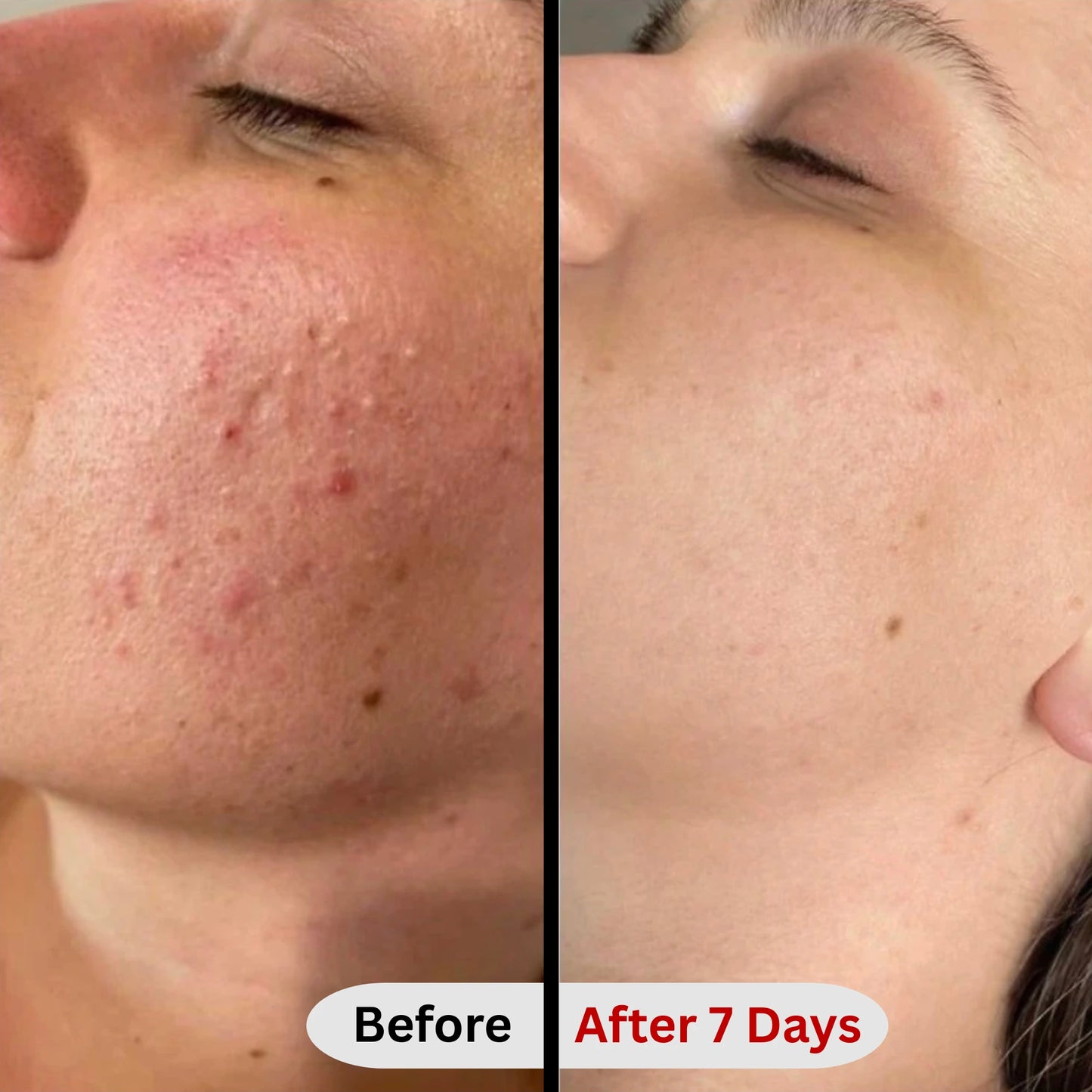 Dr.Althea 345 Relief Cream