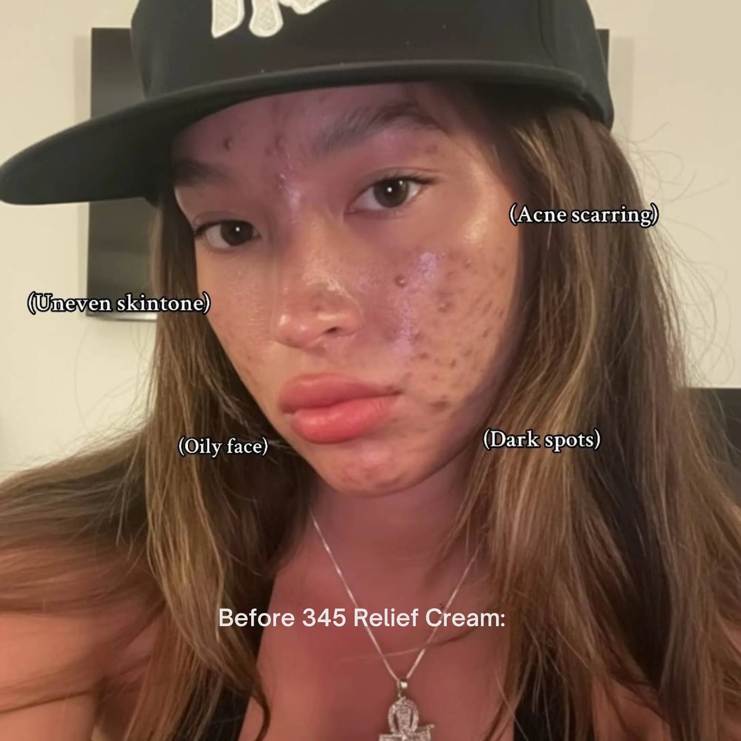 Dr.Althea 345 Relief Cream